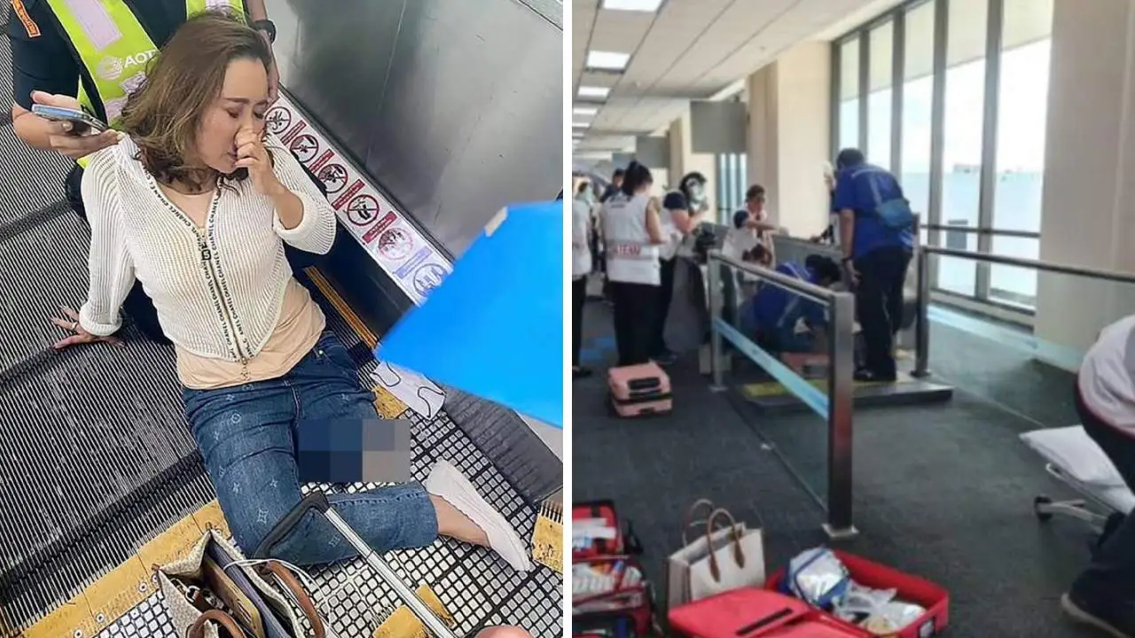 Mujer pierde una pierna tras quedar atrapada en cinta mecánica de aeropuerto